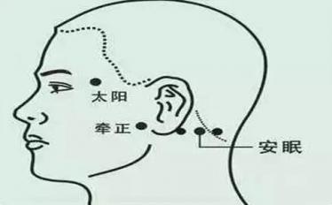 艾灸哪里可以治疗失眠1 艾灸哪里可以治疗失眠1
