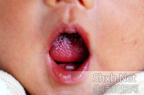 新生宝宝长出一颗小白牙