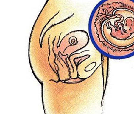 面对“胚胎停育”，你可以做些什么？？？