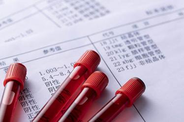 脑供血不足的原因6