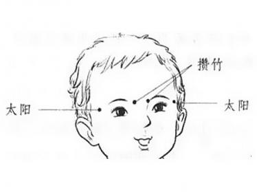 小儿急性结膜炎推拿方法1