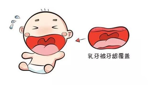 慢性鼻炎对牙齿发育的影响