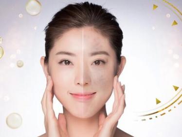 眉心长痘痘是什么原因
