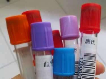 整个孕期要抽多少管血 过来人：血管都“干瘪”了