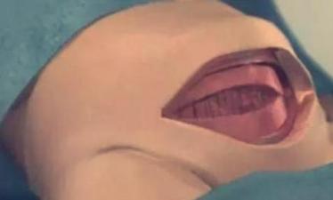 7张图揭露产妇“剖腹产”全过程，男人都该看，网友：母爱太伟大