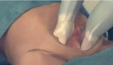 7张图揭露产妇“剖腹产”全过程，男人都该看，网友：母爱太伟大