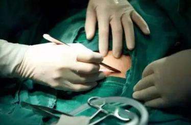 7张图揭露产妇“剖腹产”全过程，男人都该看，网友：母爱太伟大